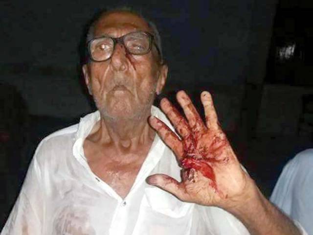 octogenarian has been beaten black and blue in a rural Sindh district for eating during the fasting month of Ramazan